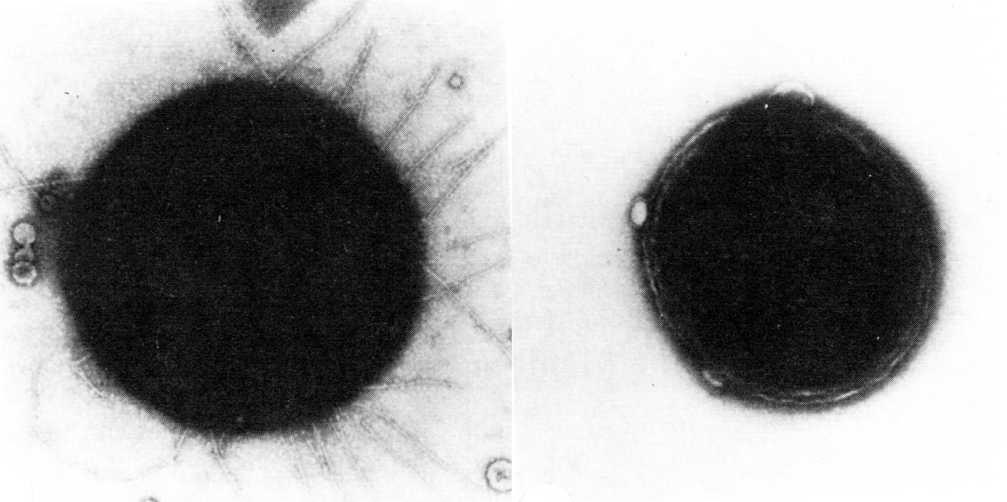 Рис. 2. Электронограммы N. meningitidis. Слева — культура, выращенная на среде, поддерживающей образование пилей, справа — тот же штамм, утративший пили