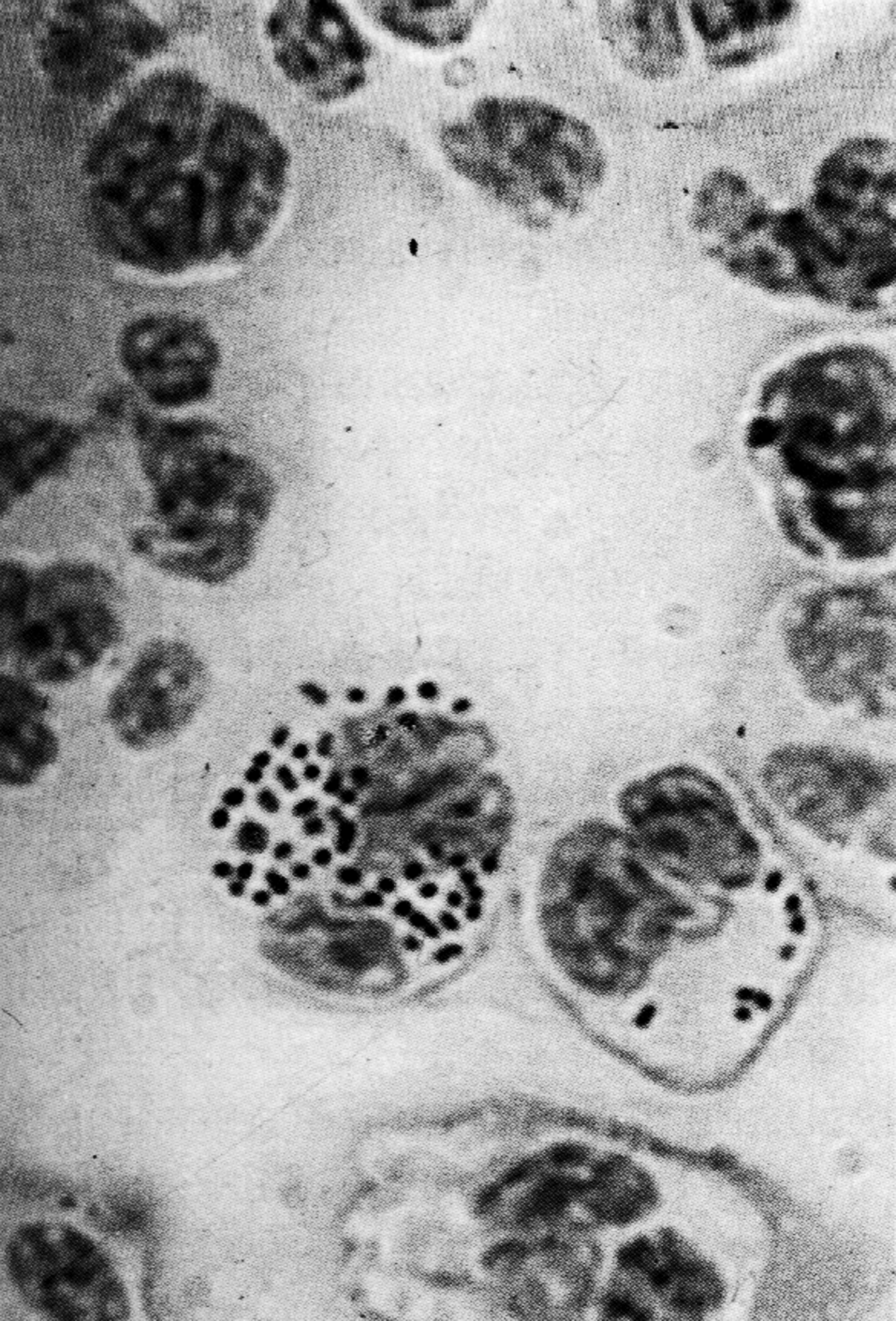 Рис. 5. N. meningitidis в цереброспинальной жидкости больного гнойным менингитом. Видны бактерии, фа- гоцитированные нейтрофилами. х1000