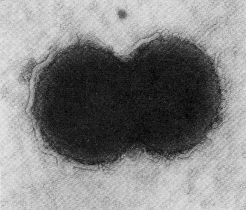 Рис. 2. Микроэлектронограмма N. gonorrhoeae. Диплококк, видны пили, отходящие в виде тонких нитей от поверхности клеток
