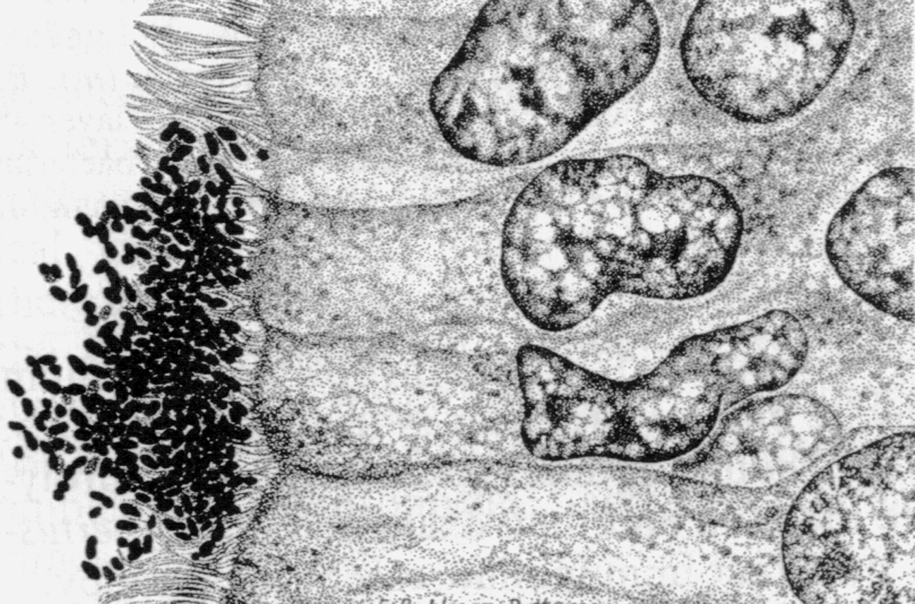 Рис. 1. Скопление коклюшных палочек между ресничками клеток на поверхности трахеи. х1500