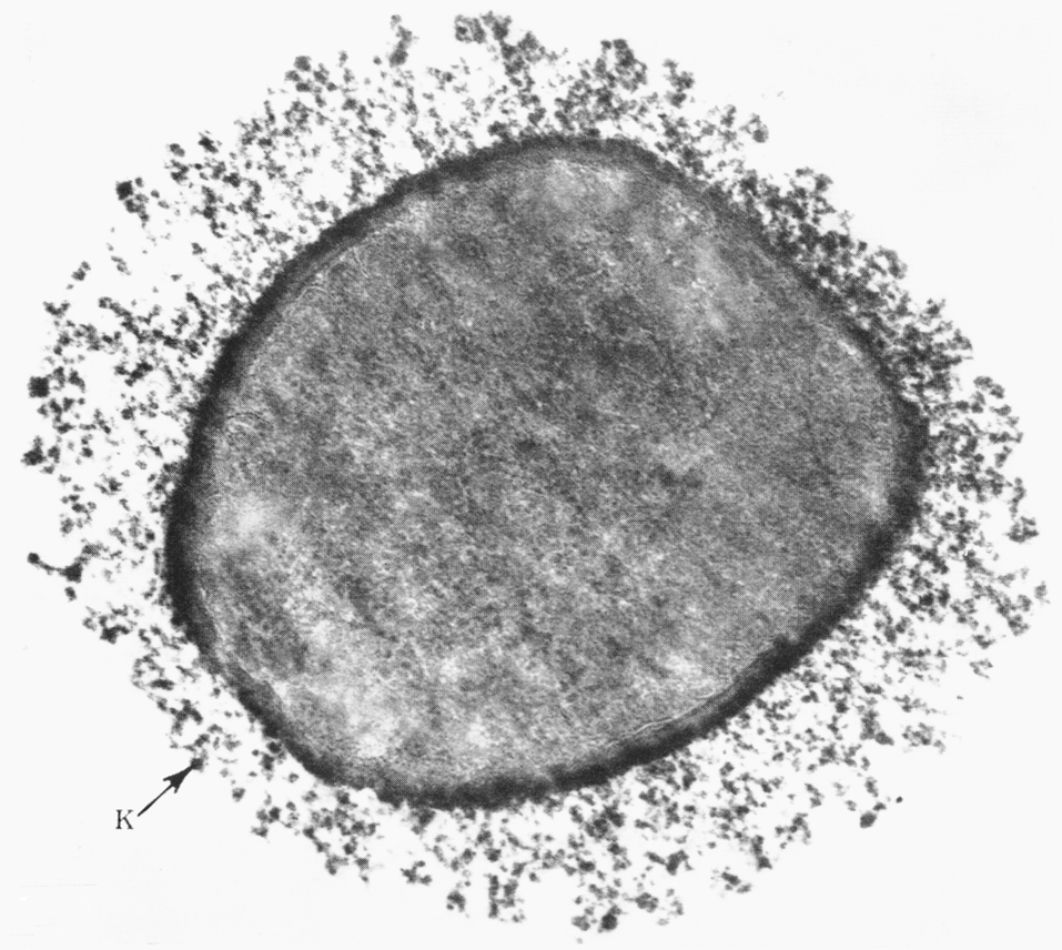 Рис. 4. Электронограмма 6-часовой культуры C. perfringens. Вокруг клетки видна массивная капсула