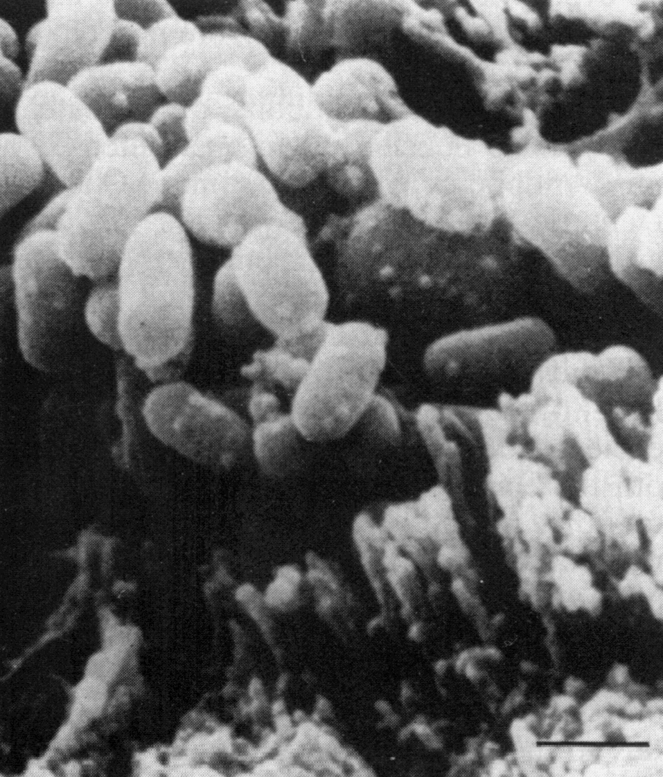 Рис. 1. E. coli на слизистой оболочке слепой кишки кролика. Сканирующая электронограмма. Полоска соответствует 1 мкм