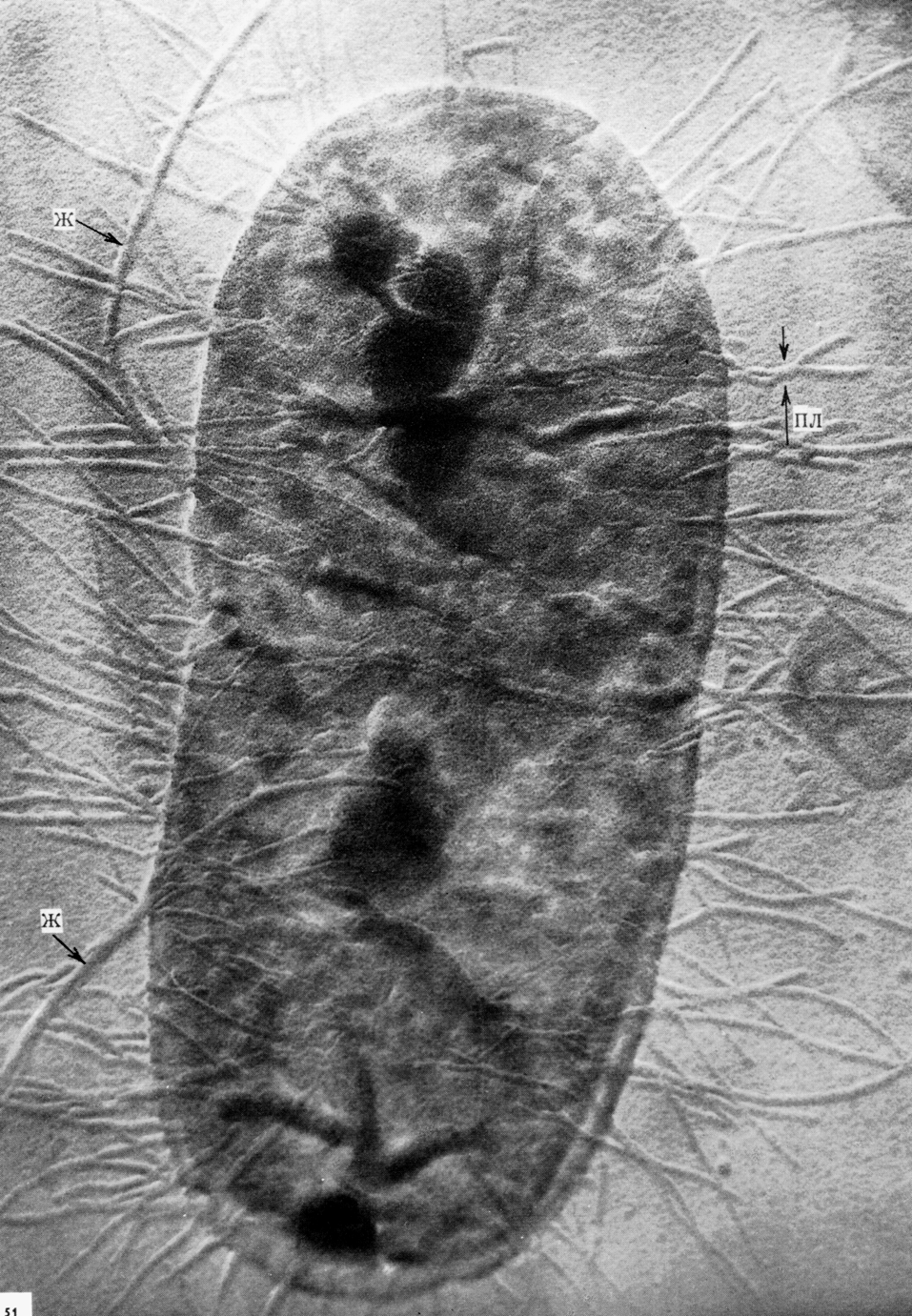 Рис. 3. Электронограмма E. coli. По периферии бактериальной клетки видны жгутики (ж) и пили (пл)