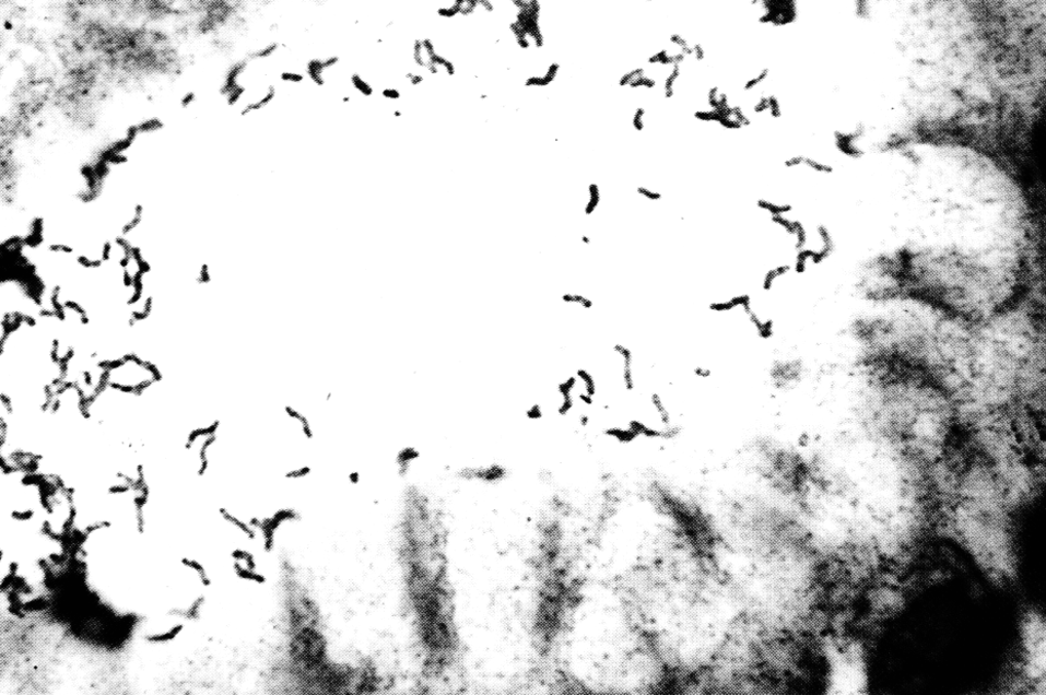 Рис. 1. H. pylori на слизистой оболочке антрального отдела желудка. Окраска серебром, х1000