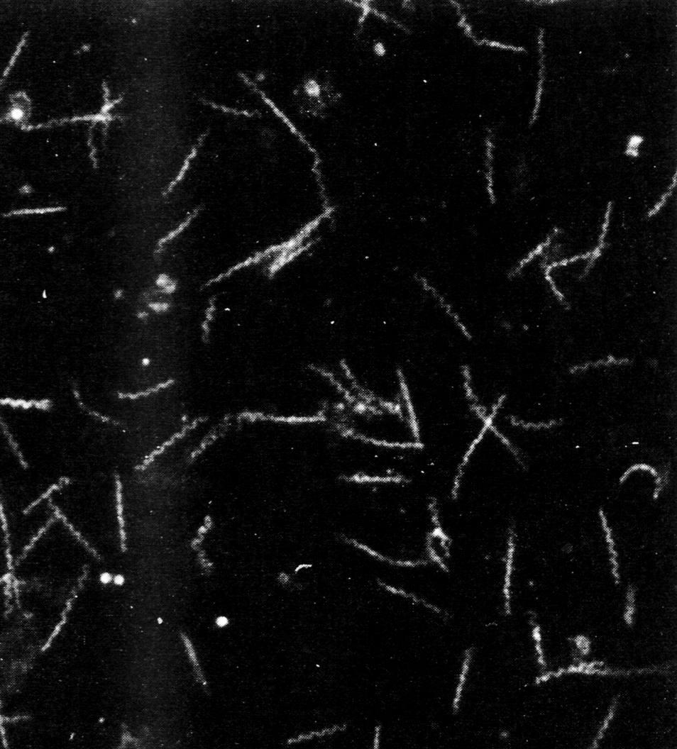 Рис. 1. Темнопольная микроскопия суспензии T. pallidum. х3000