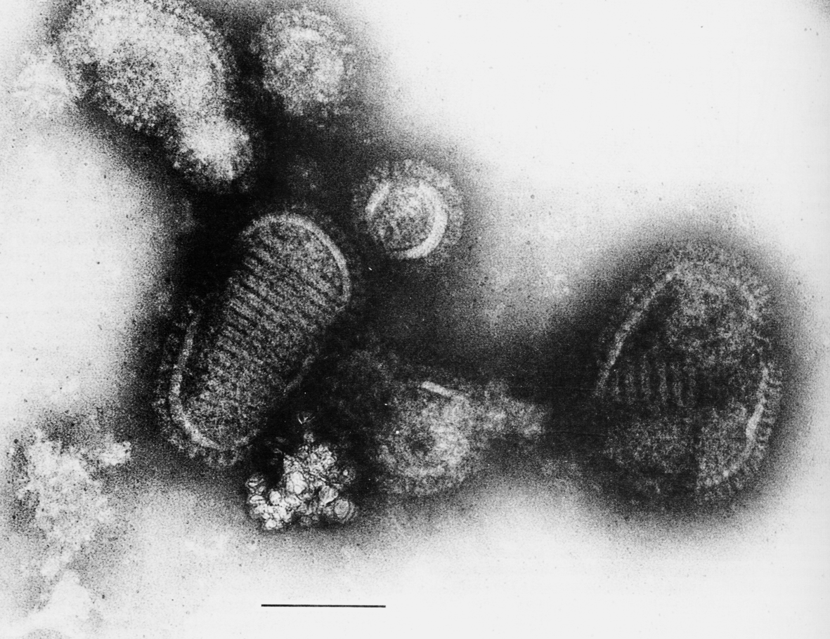 Рис. 3. Электронограмма вируса гриппа (тип А). Хорошо контурирована кайма из шипов гемагглютинина и нейраминидазы с подлежащим липидным слоем и М-белком. Внутри выделяется спиралевидный нуклеокапсид (кор). Полоска соответствует 100 нм