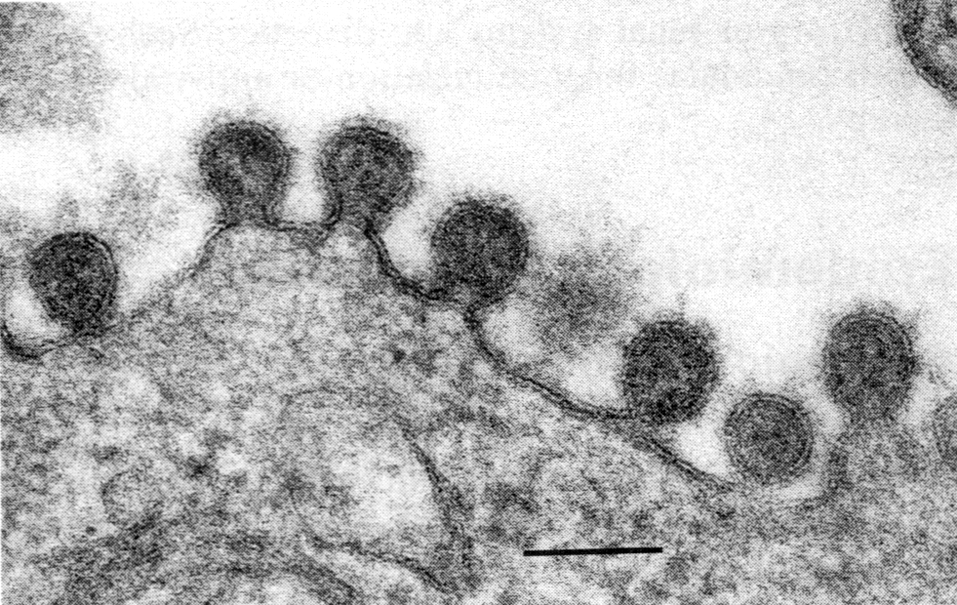 Рис. 4. Почкование вируса гриппа (палочковидные и сферические частицы). Электронограмма. Полоска соответствует 100 нм