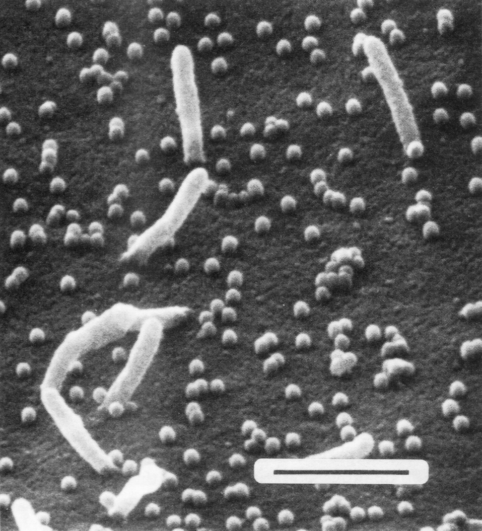 Рис. 5. Сканирующая электронограмма почкующихся вирусов гриппа. Удлиненные структуры являются микроворсинками клетки, почкующиеся вирионы выглядят как сферические частицы. Полоска соответствует 1 мкм
