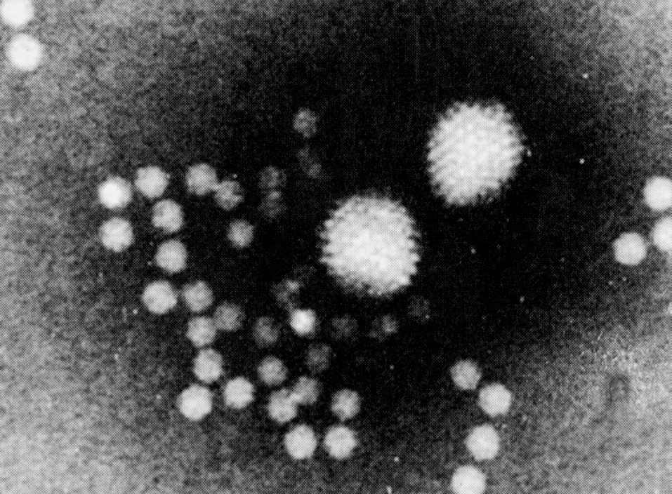 Рис. 3. Группа аденоассоциированных сателлитных парвовирусов, которые окружают два хелперных аденовируса. х250000