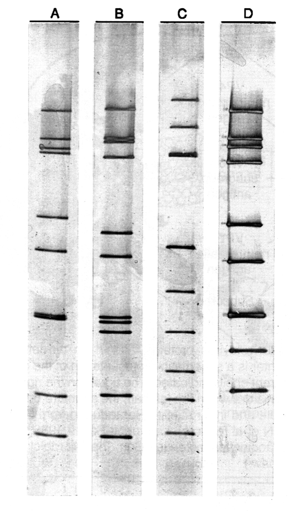Рис. 3. Электроферотип ротавирусов. Ротавирусы содержат 11 геномных РНК-сегментов, но иногда два-три сегмента мигрируют вместе и их трудно разделить. РНК (11 сегментов), экстрагированная из ротавирусных частиц, была подвергнута электрофорезу в полиакриламидном геле. «Короткий» РНК-электроферотип (он отличается укороченной подвижностью сегментов 10—11) показан на треке D; «длинные электроферотипы видны на треках A—C