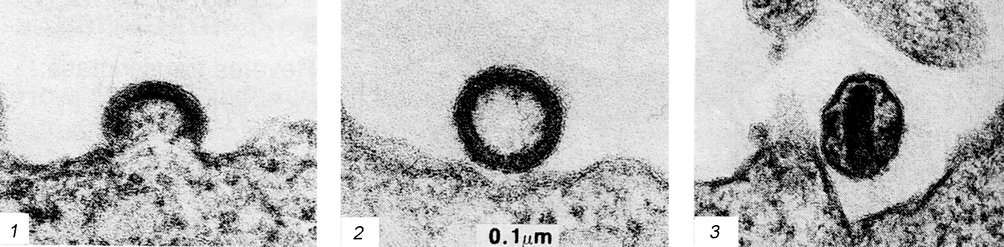 Рис. 1. Электронограммы, демонстрирующие последовательные стадии сборки и почкования ВИЧ. В зрелом вирионе сердцевина имеет коническую форму