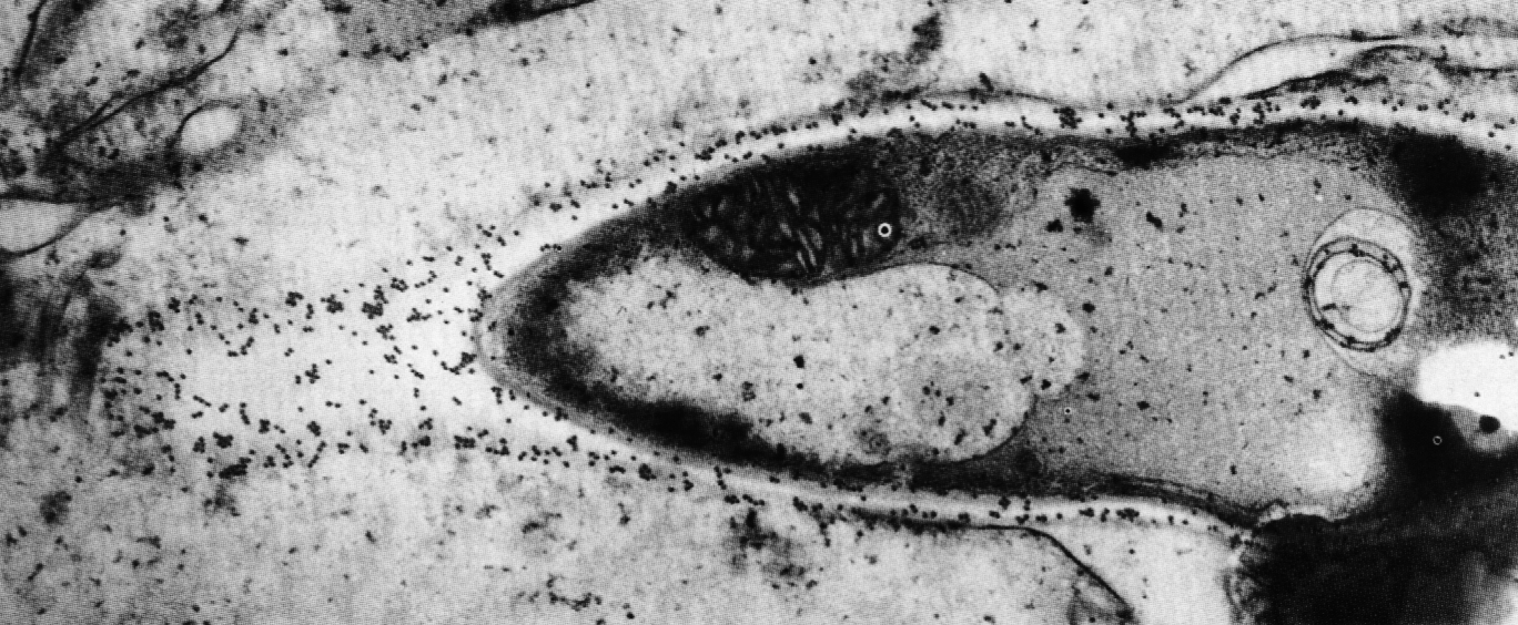 Рис. 12. Иммуноэлектронограмма, демонстрирующая секрецию фосфолипазы В концом гифы Candida albicans, инвазирующей ткани гастроинтестинального тракта мыши