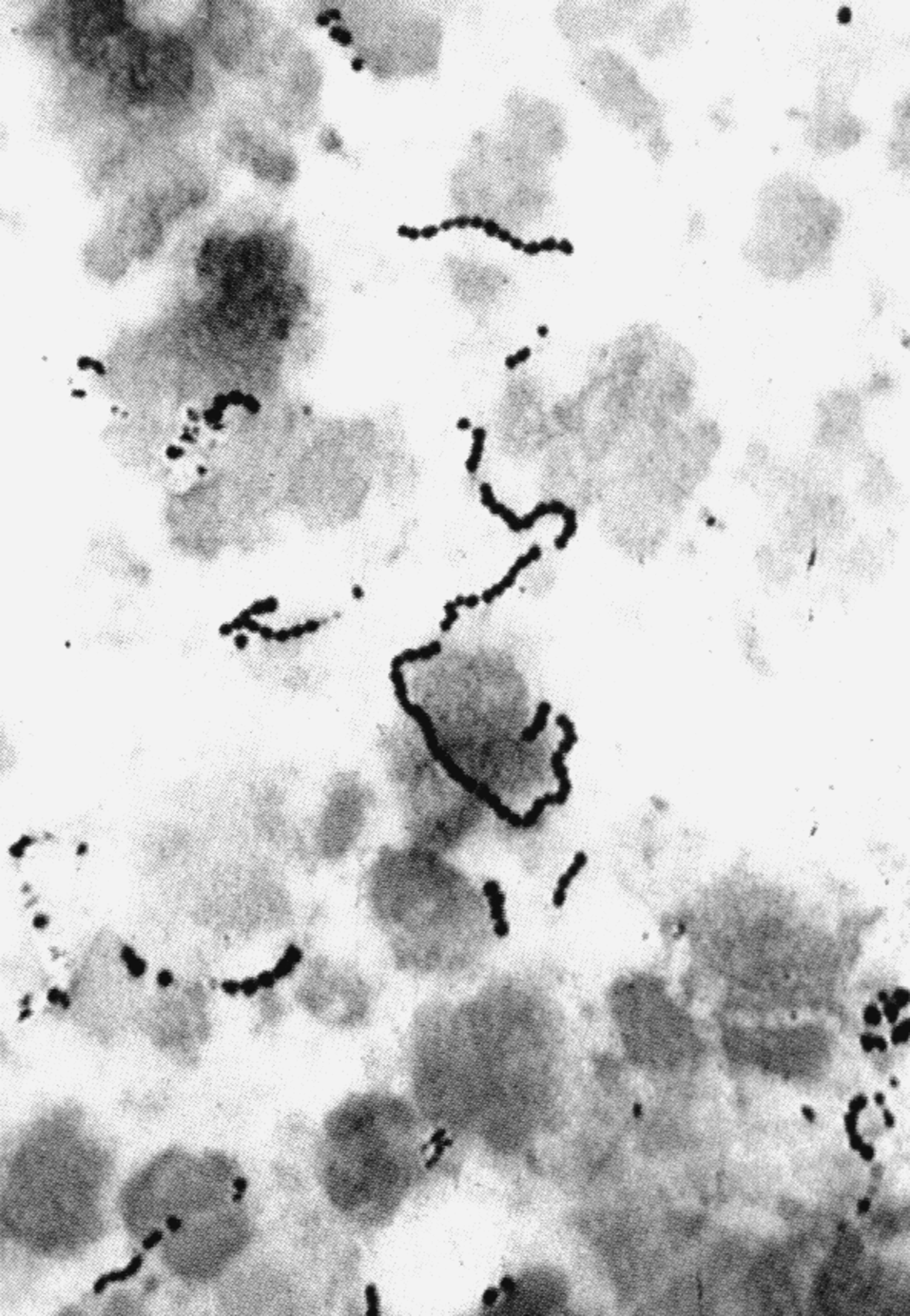 Рис. 1. Str. pyogenes в мазке из гноя (эмпиема плевральной полости). *1000