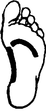 Рис. 9. Гипсовая повязка на стопе должна быть тщательно моделирована по двум сводам стопы: один — по внутренней ее поверхности, другой — по головкам плюсневых костей